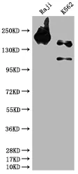 INPP5D Recombinant Monoclonal Antibody - image 1