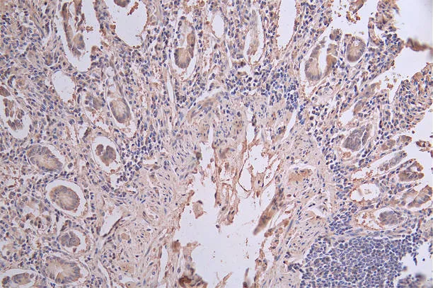 KRT20 Recombinant Monoclonal Antibody - image 1