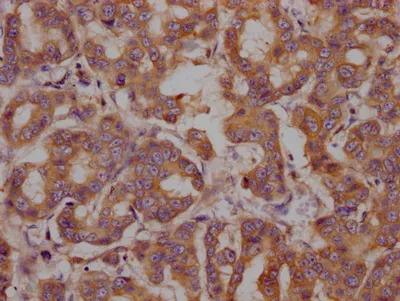 HSPA5 Recombinant Monoclonal Antibody - image 1