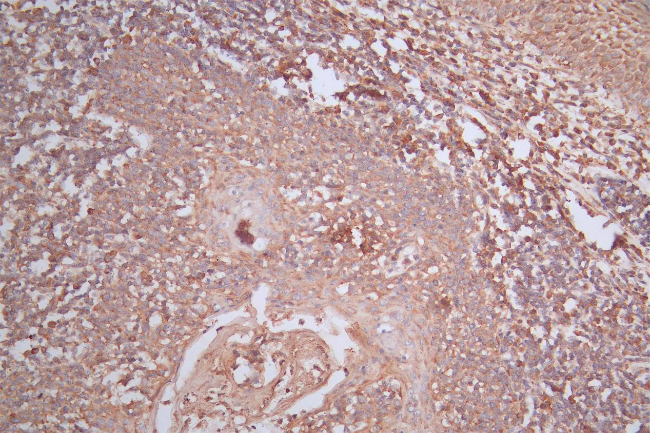 MS4A1 Recombinant Monoclonal Antibody - image 1