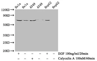 Phospho-PXN (Y118) Recombinant Monoclonal Antibody - image 1
