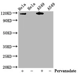 Phospho-JAK2 (Y1007 + Y1008) Recombinant Monoclonal Antibody - image 1
