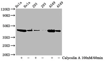 Phospho-GSK3B (Ser9) Recombinant Monoclonal Antibody - image 1