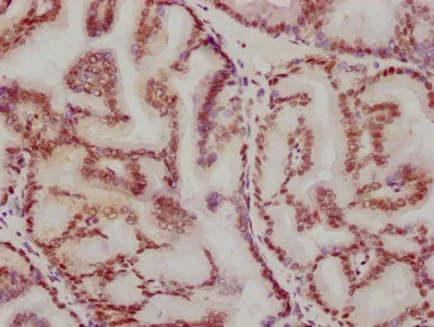 ATF2 Recombinant Monoclonal Antibody - image 2