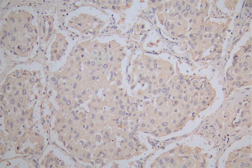 CD274 Recombinant Monoclonal Antibody - image 1