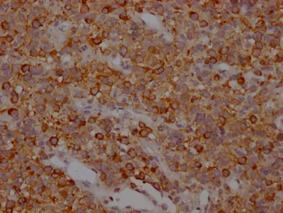 MAPT Recombinant Monoclonal Antibody - image 1