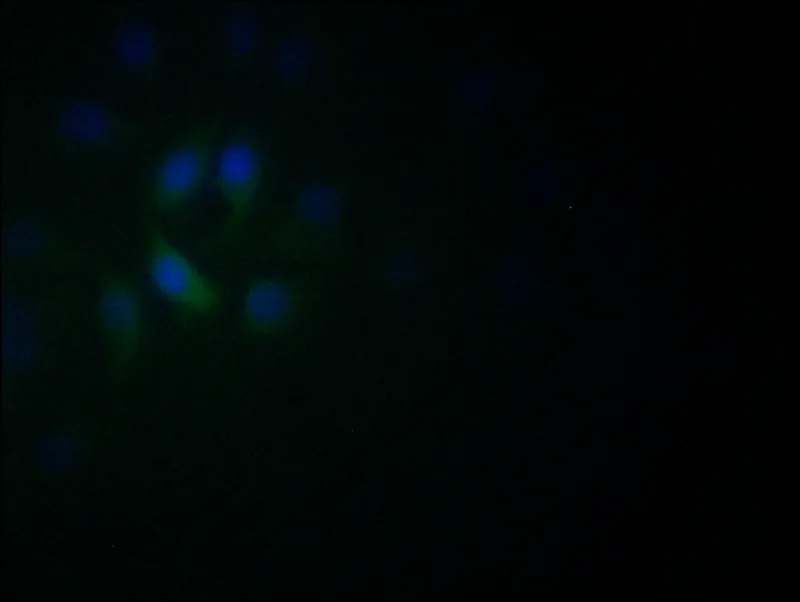 NEUROD1 Recombinant Monoclonal Antibody - image 1