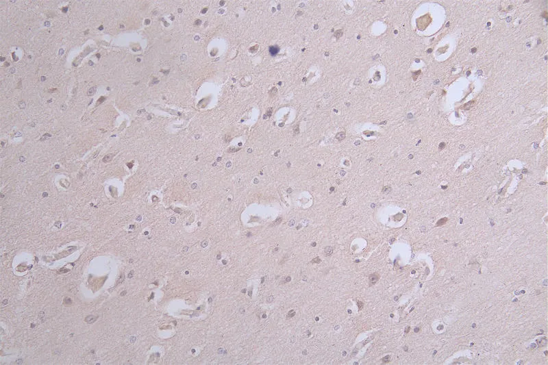 Phospho-MAPT (S214) Recombinant Monoclonal Antibody - image 1