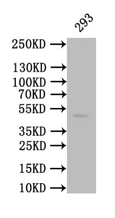CALR Recombinant Monoclonal Antibody - image 1