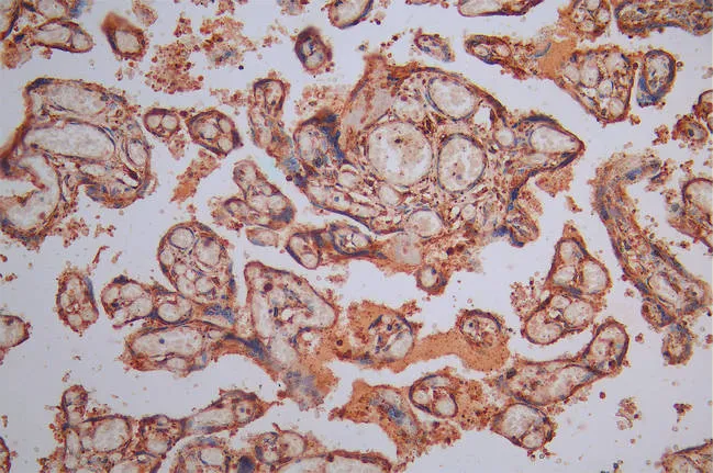 CALR Recombinant Monoclonal Antibody - image 2