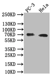 ALPP Recombinant Monoclonal Antibody - image 1