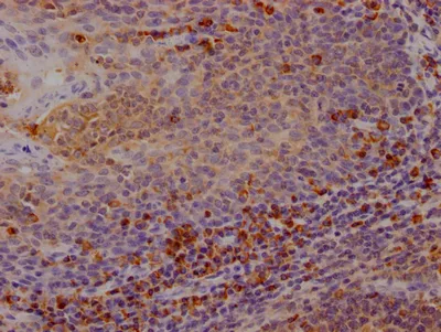CTLA4 Recombinant Monoclonal Antibody - image 1