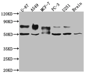 TPBG Recombinant Monoclonal Antibody - image 1