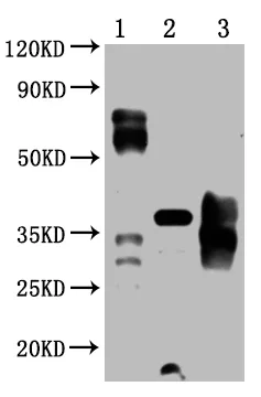 PD-1 Monoclonal Antibody - image 1