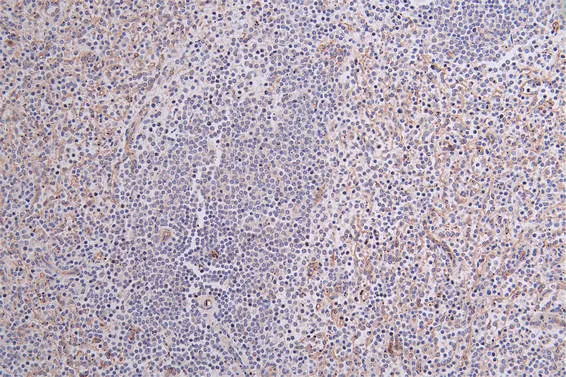 CD36 Recombinant Monoclonal Antibody - image 1