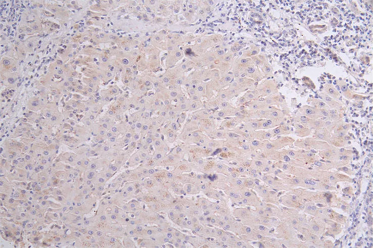 CD36 Recombinant Monoclonal Antibody - image 2