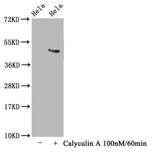 Phospho-MAPT (T231) Recombinant Monoclonal Antibody - image 1