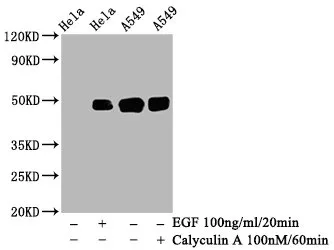 Phospho-JUN (S63) Recombinant Monoclonal Antibody - image 1