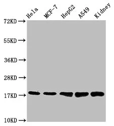 TSPO Recombinant Monoclonal Antibody - image 1