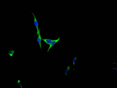 FGFR3 Recombinant Monoclonal Antibody - image 1