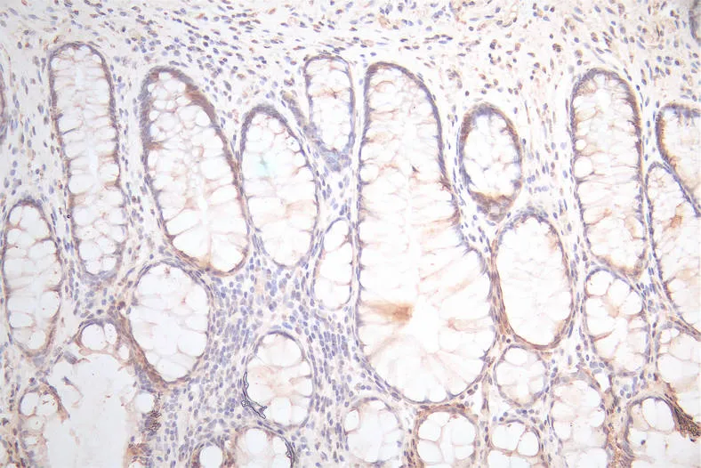 UBE2C Recombinant Monoclonal Antibody - image 1