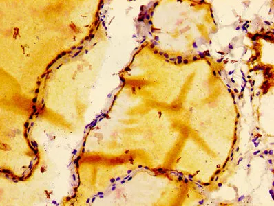 BCL2 Recombinant Monoclonal Antibody - image 2