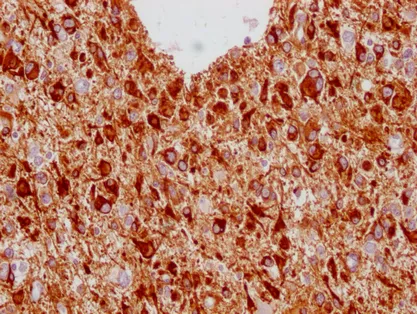 GFAP Monoclonal Antibody - image 1