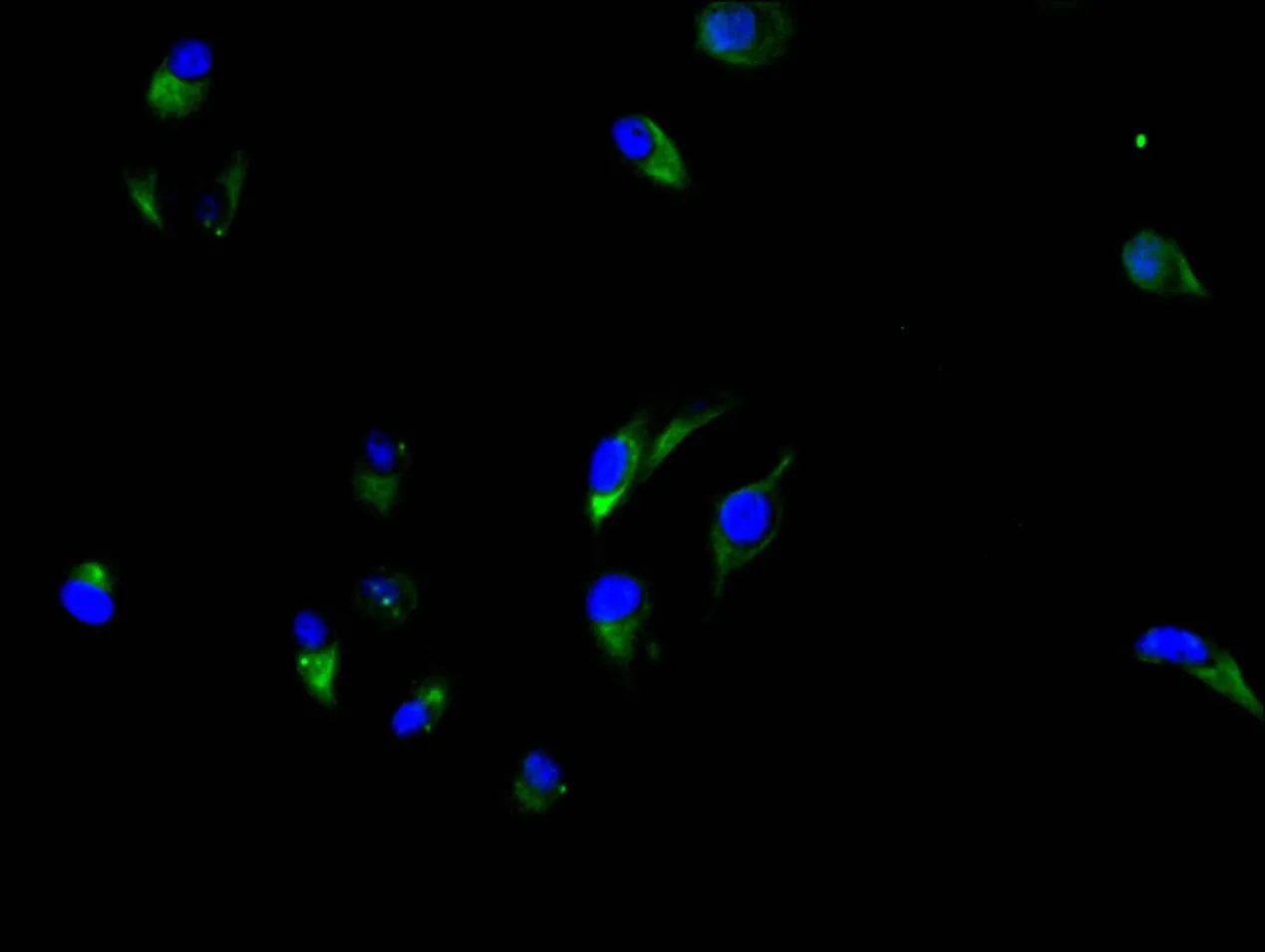 CEACAM5 Recombinant Monoclonal Antibody - image 1