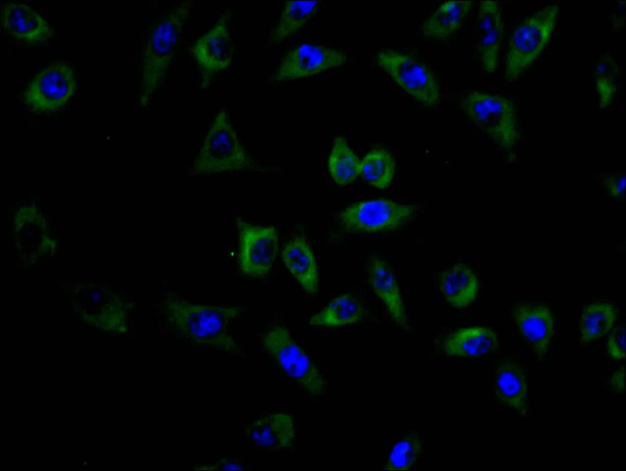 CEACAM5 Recombinant Monoclonal Antibody - image 2