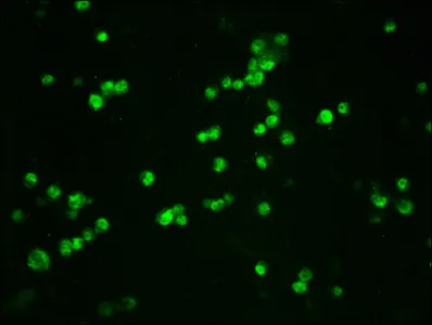 Phospho-CTNNB1 (S33/S37) Recombinant Monoclonal Antibody - image 1