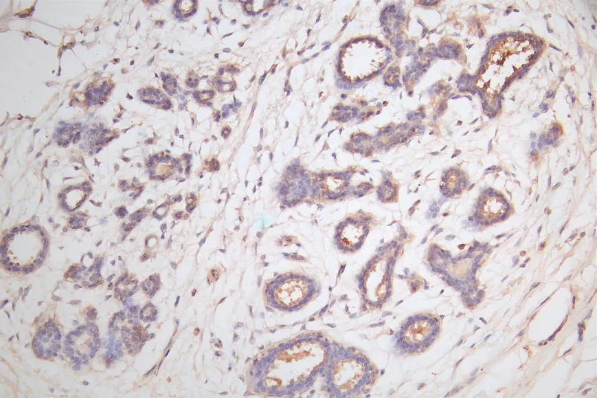 CTNNB1 Recombinant Monoclonal Antibody - image 1