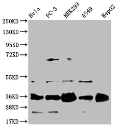 HMGCL Recombinant Monoclonal Antibody - image 2