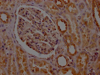 PTGER2 Recombinant Monoclonal Antibody - image 1