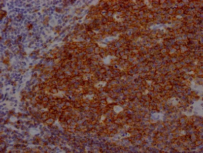 CD19 Recombinant Monoclonal Antibody - image 2