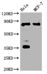 STAT3 Recombinant Monoclonal Antibody - image 1