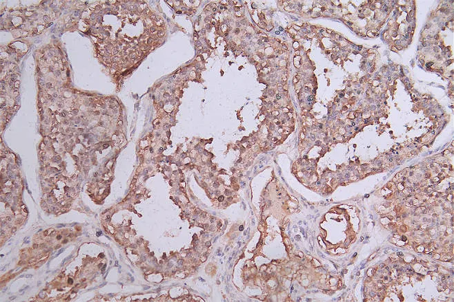 HSP90AB1 Recombinant Monoclonal Antibody - image 1