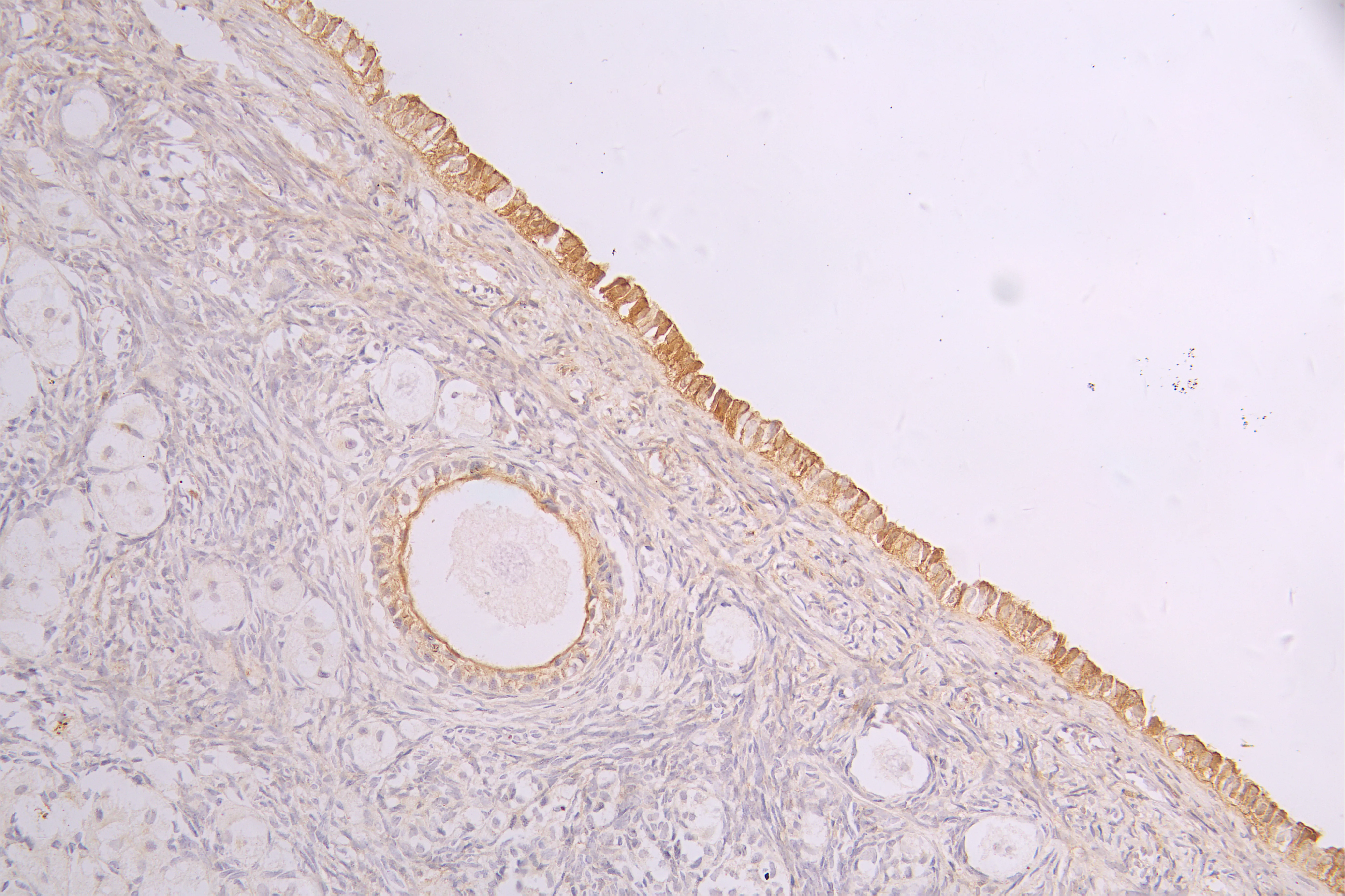 ROR2 Recombinant Monoclonal Antibody - image 1