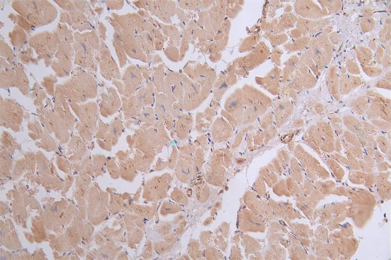 ATP2A2 Recombinant Monoclonal Antibody - image 1