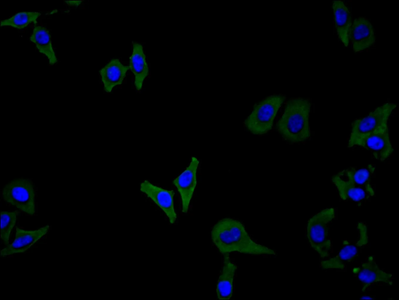 CSF2RB Recombinant Monoclonal Antibody - image 1