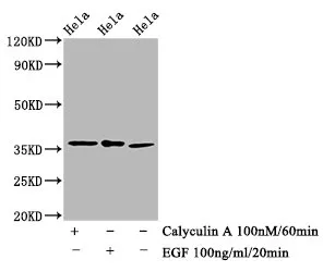 Phospho-EIF2S1 (S51) Recombinant Monoclonal Antibody - image 1