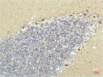 PPARD Monoclonal Antibody - image 1