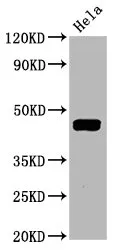 Phospho-MAP2K1 (T292) Recombinant Monoclonal Antibody - image 1