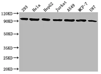 NR3C1 Recombinant Monoclonal Antibody - image 1
