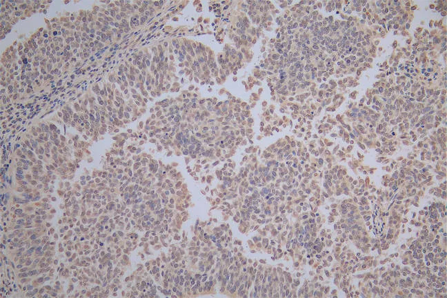 HSPB1 Recombinant Monoclonal Antibody - image 1
