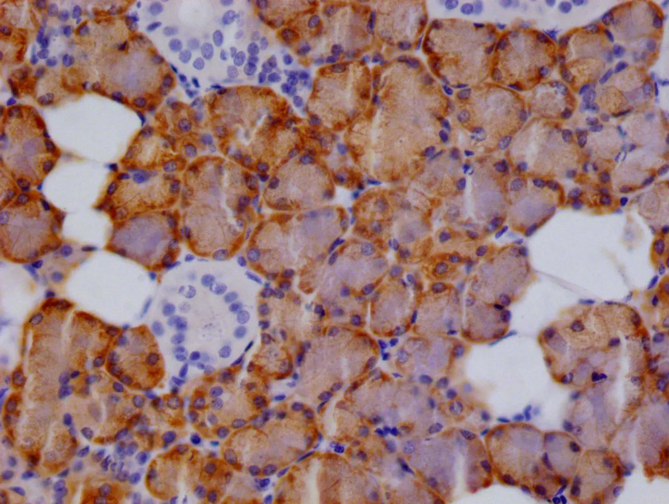 CTPS1 Recombinant Monoclonal Antibody - image 1