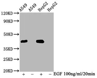 Phospho-MAPK3 (T202) + MAPK1 (T185) Recombinant Monoclonal Antibody - image 1