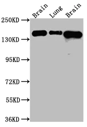 FGFR2 Recombinant Monoclonal Antibody - image 1
