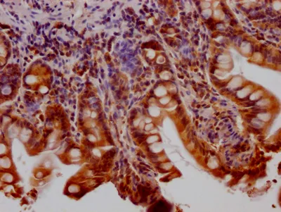 HTT Recombinant Monoclonal Antibody - image 1