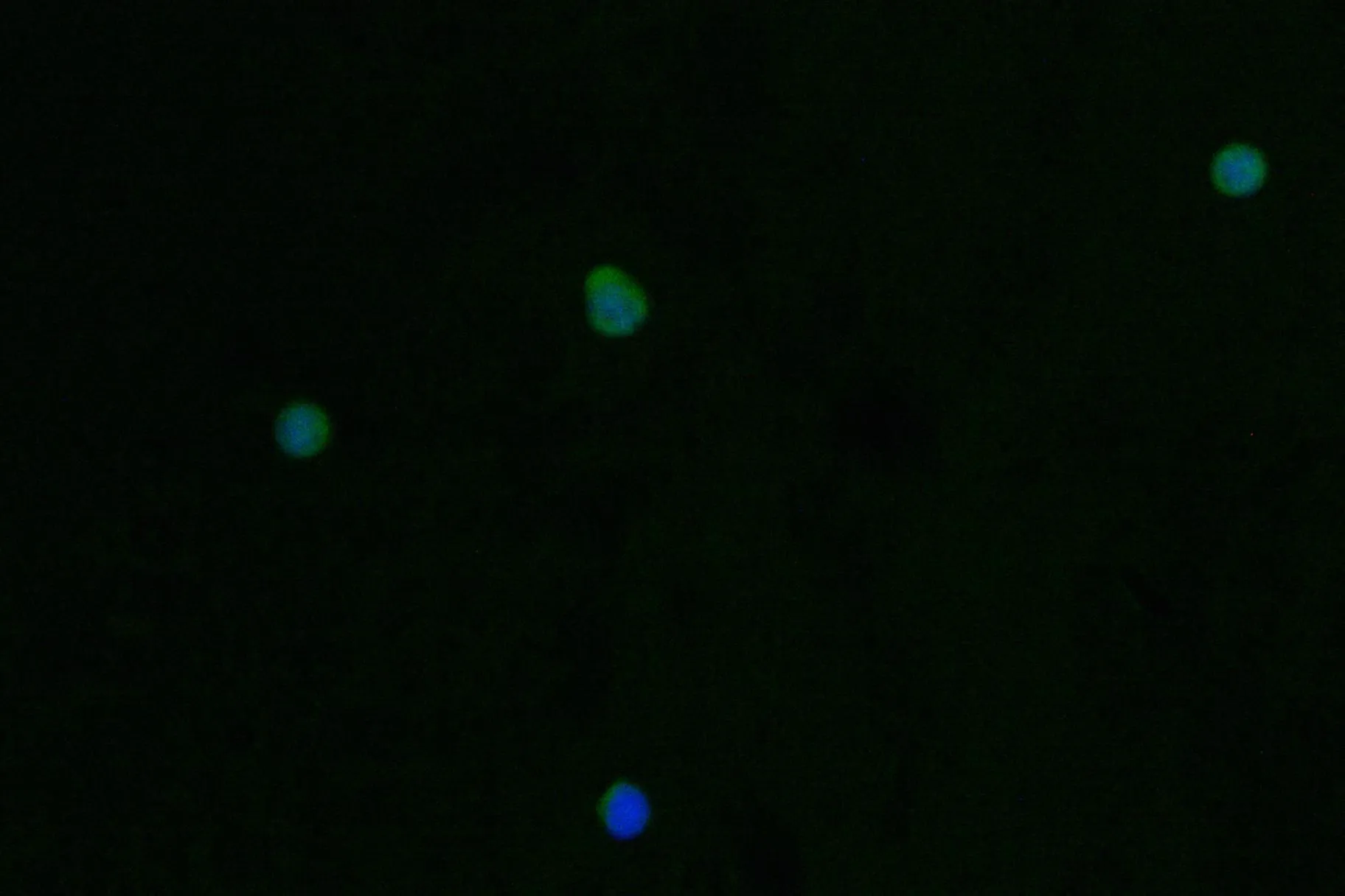 PRSS2 Recombinant Monoclonal Antibody - image 1