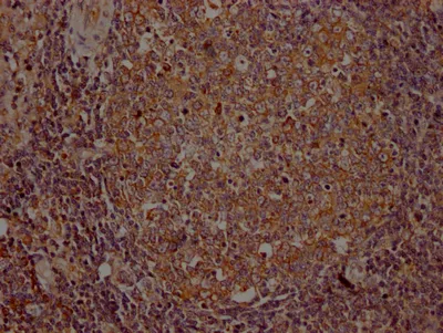 ITK Recombinant Monoclonal Antibody - image 1
